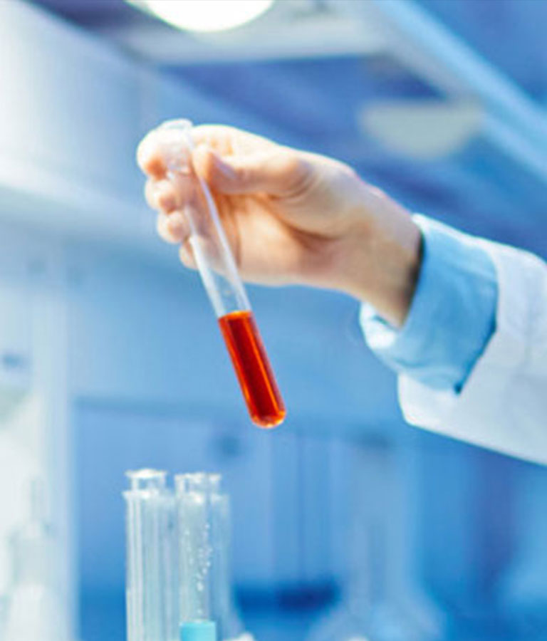 Peptide synthesis_Custom Peptide Synthesis